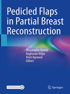 cover image of Pedicled Flaps in Partial Breast Reconstruction